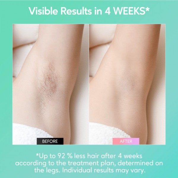INNZA IPL Hair Removal Device for Women and Men at Home,Permanent Hair Remover Machine,10 Energy Levels,24J High Energy Hair Removal Handset for Face Bikini Line Armpit Leg Back,Corded