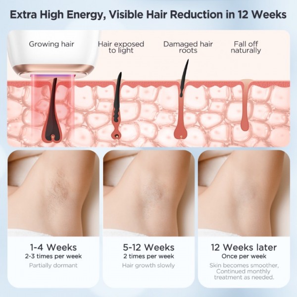 INNZA Laser Hair Removal with Ice Cooling Care Function for Women Permanent,999,999 Flashes Painless IPL Hair Remover, Hair Removal Device for Armpits Legs Arms Bikini Line (1-White)